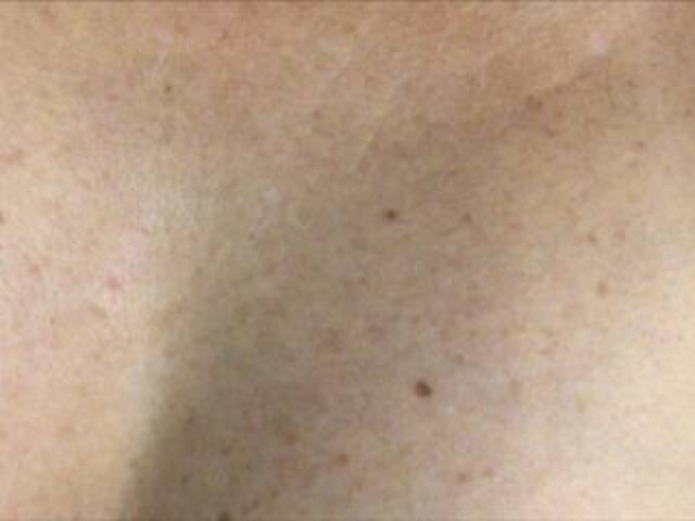 Transliacijos ekrano nuotraukos Alianakiss