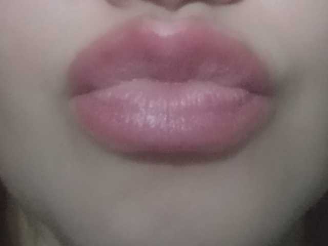 Profilio nuotrauka redfoxySo